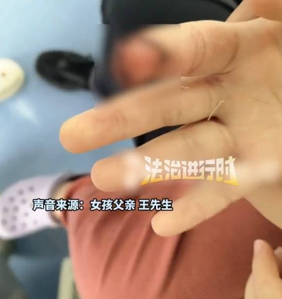 皇冠信用網申请
_北京7岁女童喂马时被咬伤手指指甲断裂皇冠信用網申请
,度假区致歉:先行支付10万元